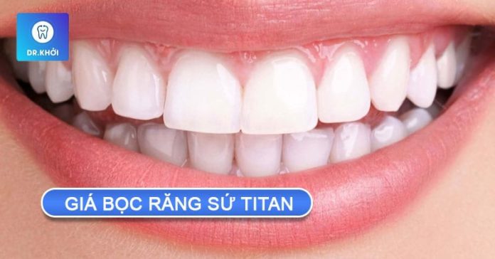 giá bọc răng sứ titan